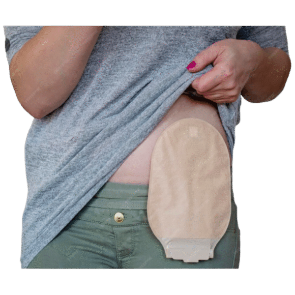 BOLSA COLOSTOMIA - KANGLI CARE - VITAMEDICAL - Imagem 2