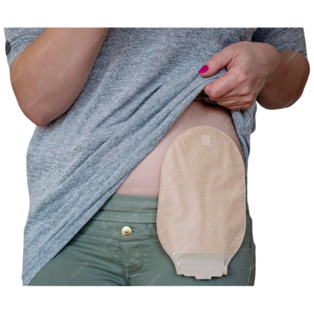 BOLSA COLOSTOMIA - KANGLI CARE - VITAMEDICAL - Imagem 2